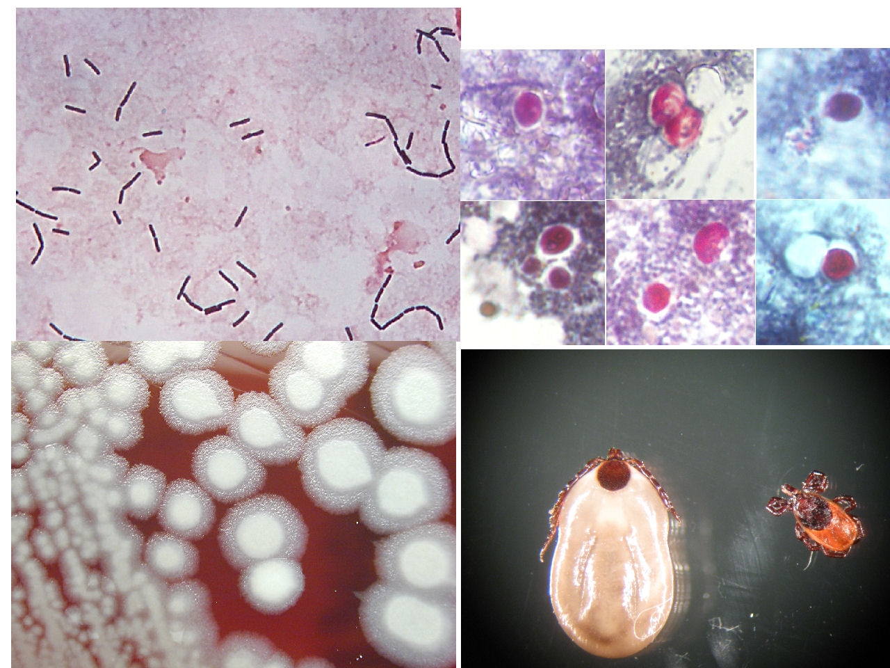 Collage of microbiology images