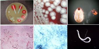 Collage of Microbiology images